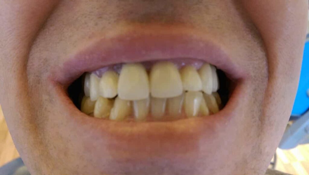 Relax Dental Center