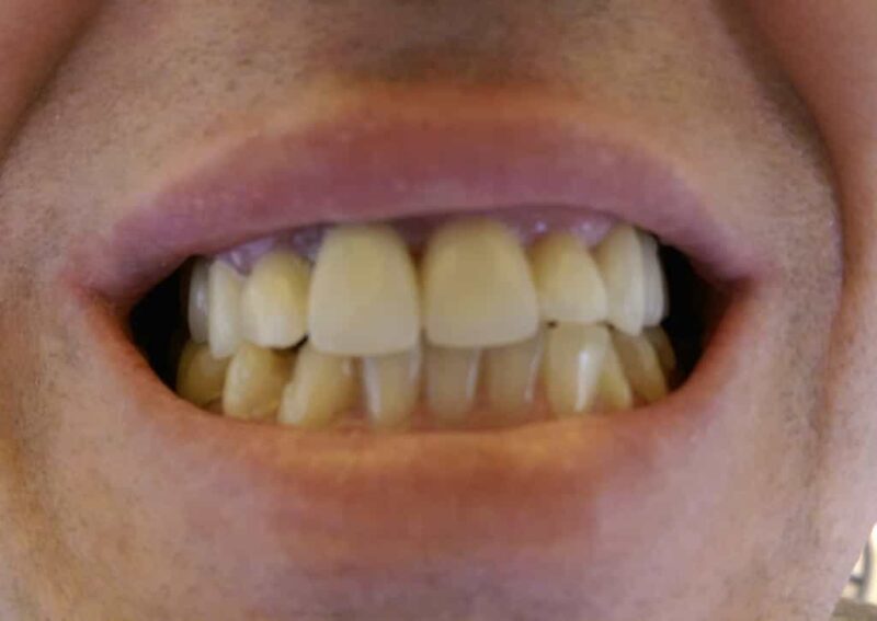 Relax Dental Center