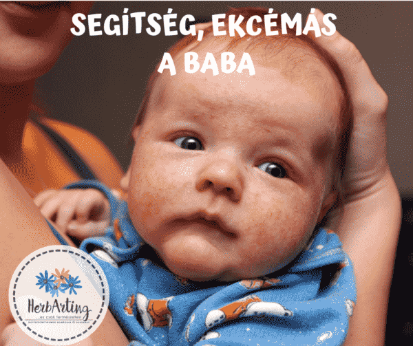 ekcéma baba